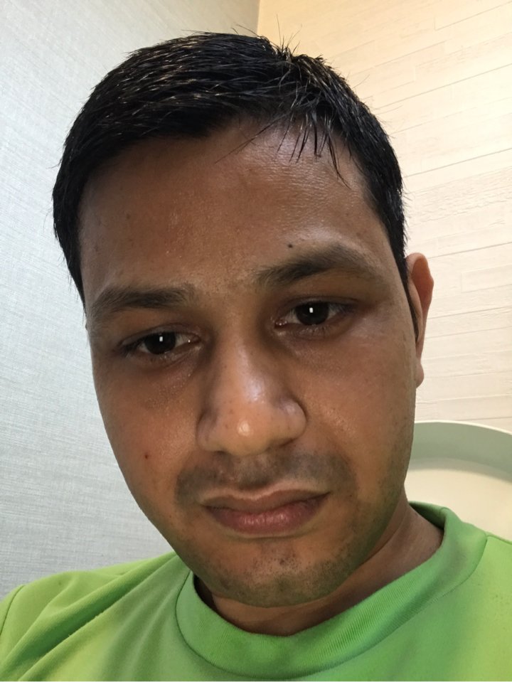 akki