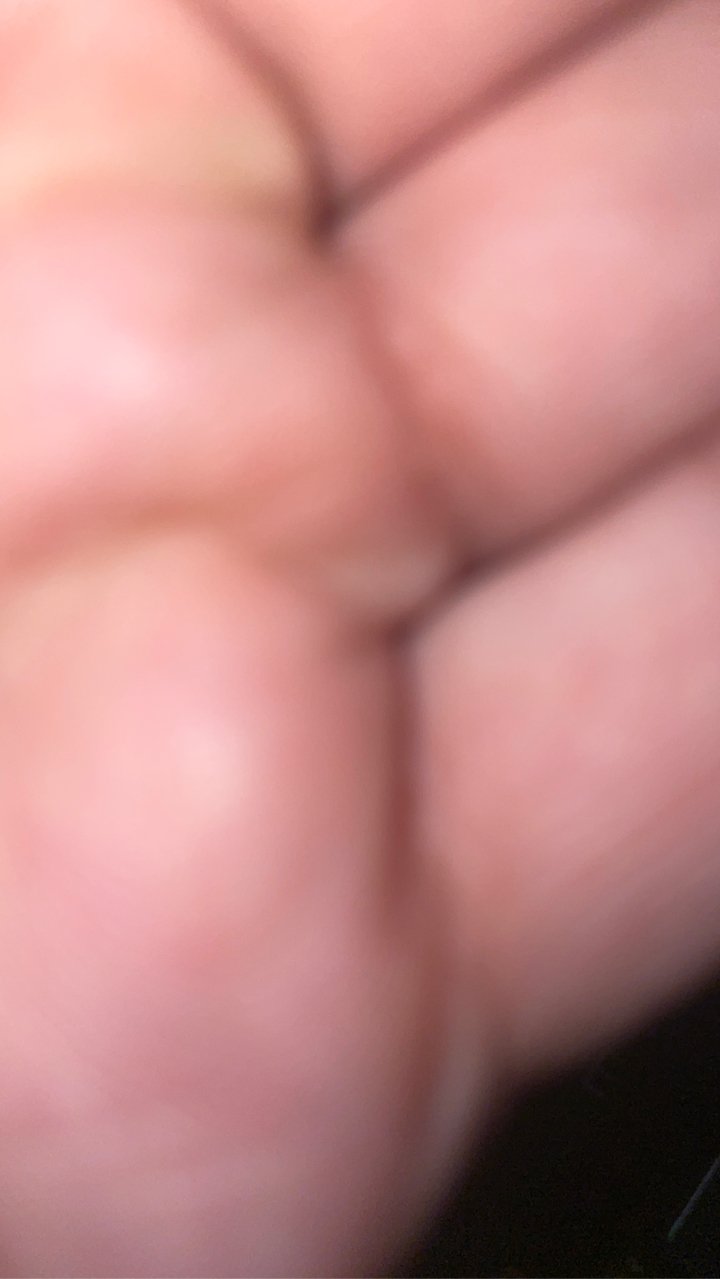 Retain