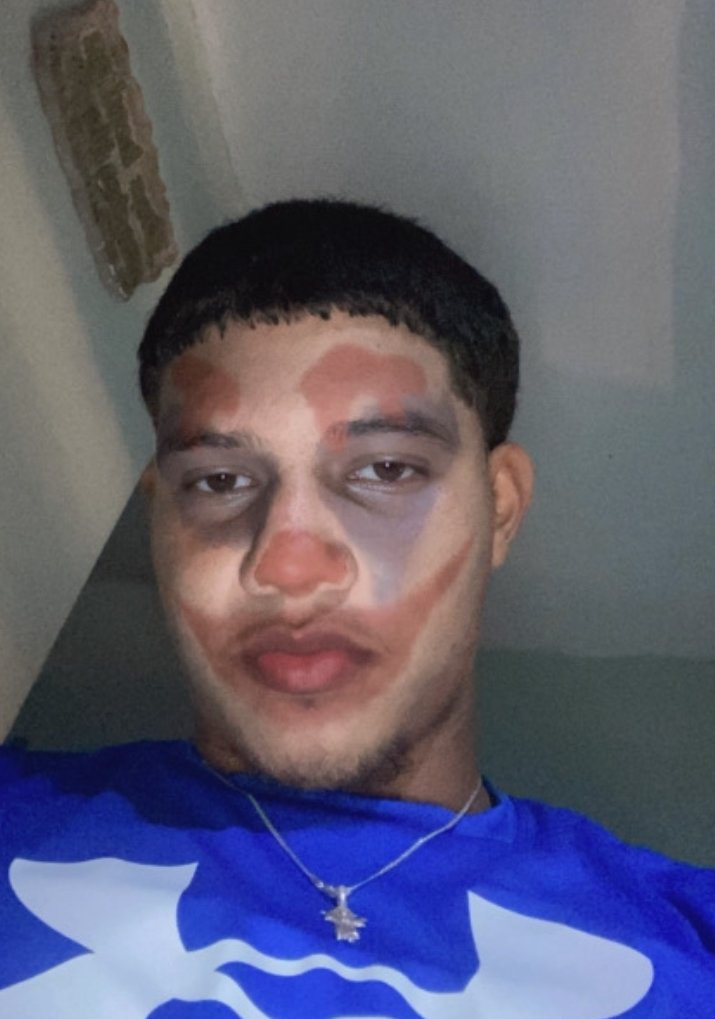 Hiraldo anthony