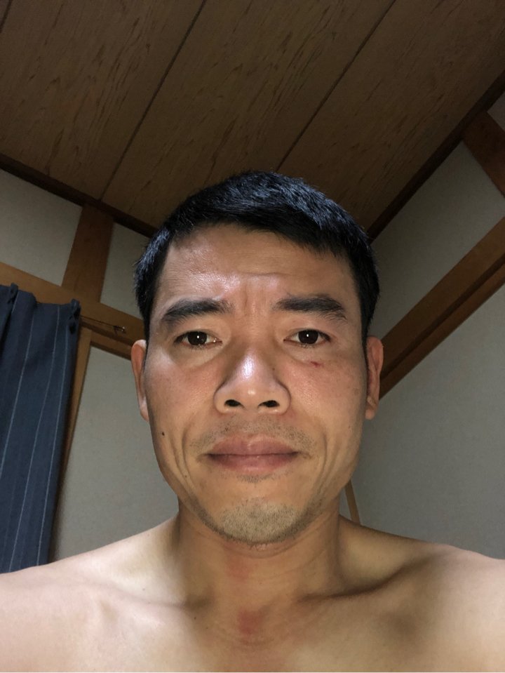 Nguyễn Quyết