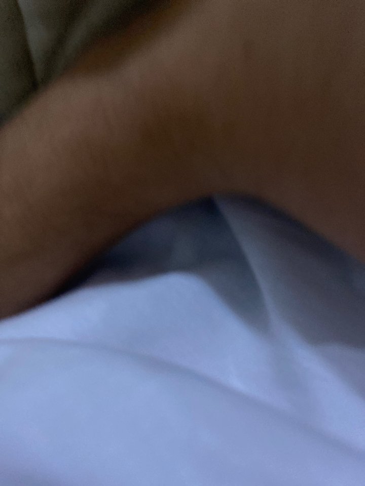 gycch